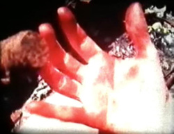 Brain Damage thumbnail